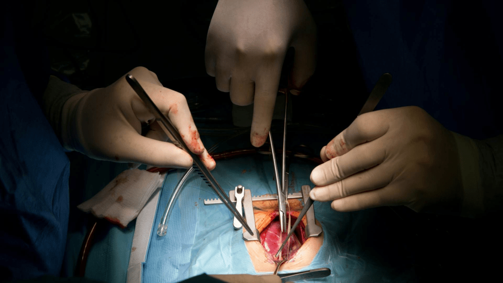 Pacientes trasplantadas piden combatir tabúes que frenan la donación de órganos en&nbsp;México